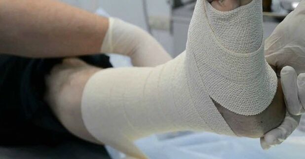 Bandaj elastic