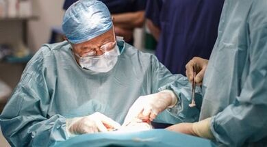 Tratamentul chirurgical al varicelor