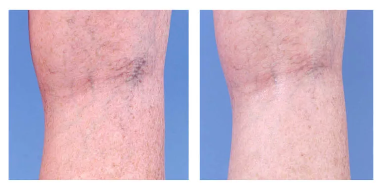 Corecție cosmetică